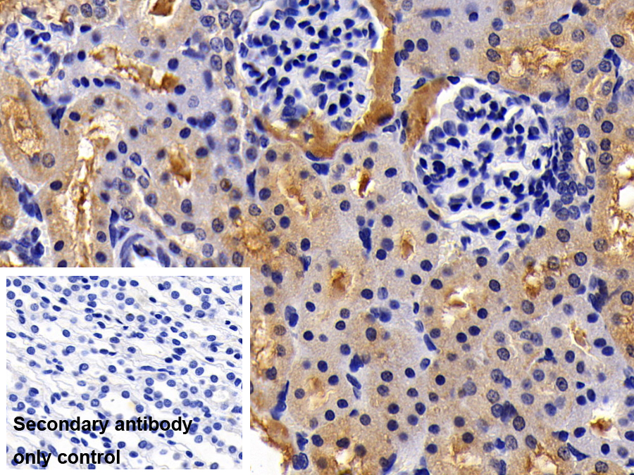 Polyclonal Antibody to Immunoglobulin Superfamily Containing Leucine Rich Repeat Protein (ISLR)