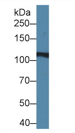 Polyclonal Antibody to Iron Responsive Element Binding Protein 2 (IREB2)