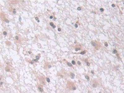 Polyclonal Antibody to Exosome Component 2 (EXOSC2)