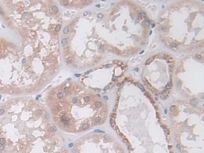 Polyclonal Antibody to Isocitrate Dehydrogenase 2, mitochondrial (IDH2)