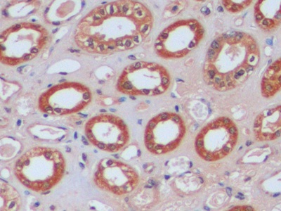 Polyclonal Antibody to Isocitrate Dehydrogenase 1, Soluble (IDH1)