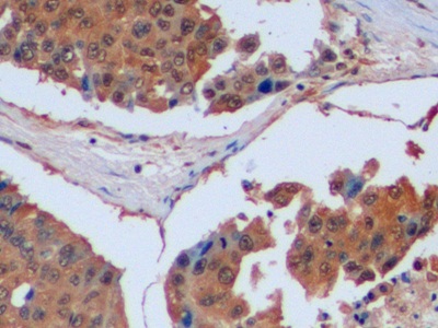 Polyclonal Antibody to Isocitrate Dehydrogenase 1, Soluble (IDH1)