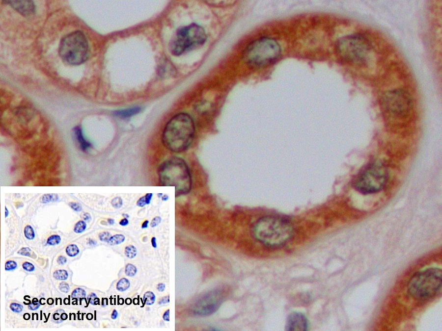 Polyclonal Antibody to Isocitrate Dehydrogenase 1, Soluble (IDH1)