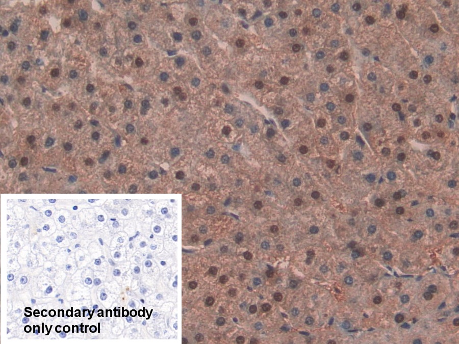 Polyclonal Antibody to Isocitrate Dehydrogenase 1, Soluble (IDH1)