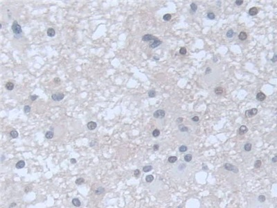 Polyclonal Antibody to Guanylate Cyclase 1 Beta 3 (GUCY1b3)
