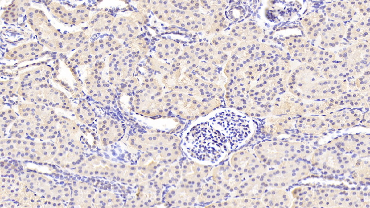 Polyclonal Antibody to Guanylate Cyclase 1 Beta 3 (GUCY1b3)