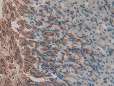 Polyclonal Antibody to Gastrokine 2 (GKN2)