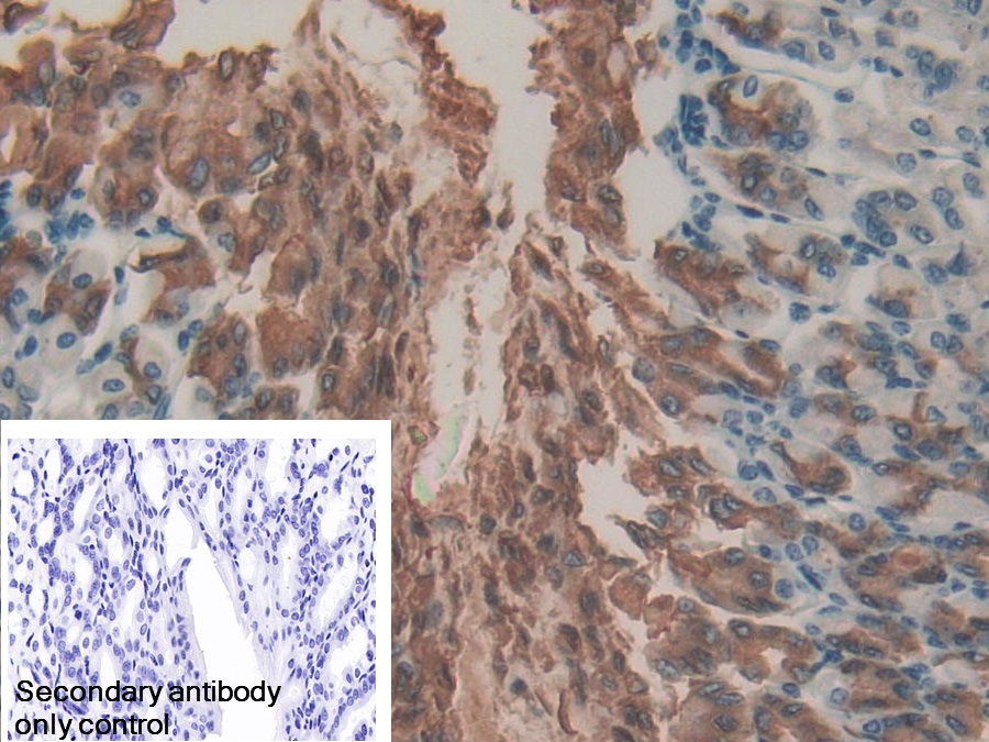 Polyclonal Antibody to Gastrokine 2 (GKN2)