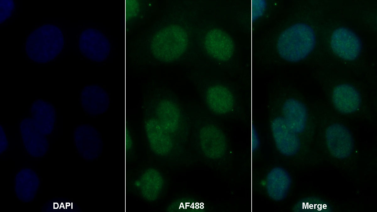 Polyclonal Antibody to Guanine Deaminase (GDA)