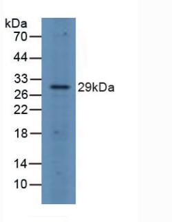 Polyclonal Antibody to FOS Like Antigen 1 (FOSL1)