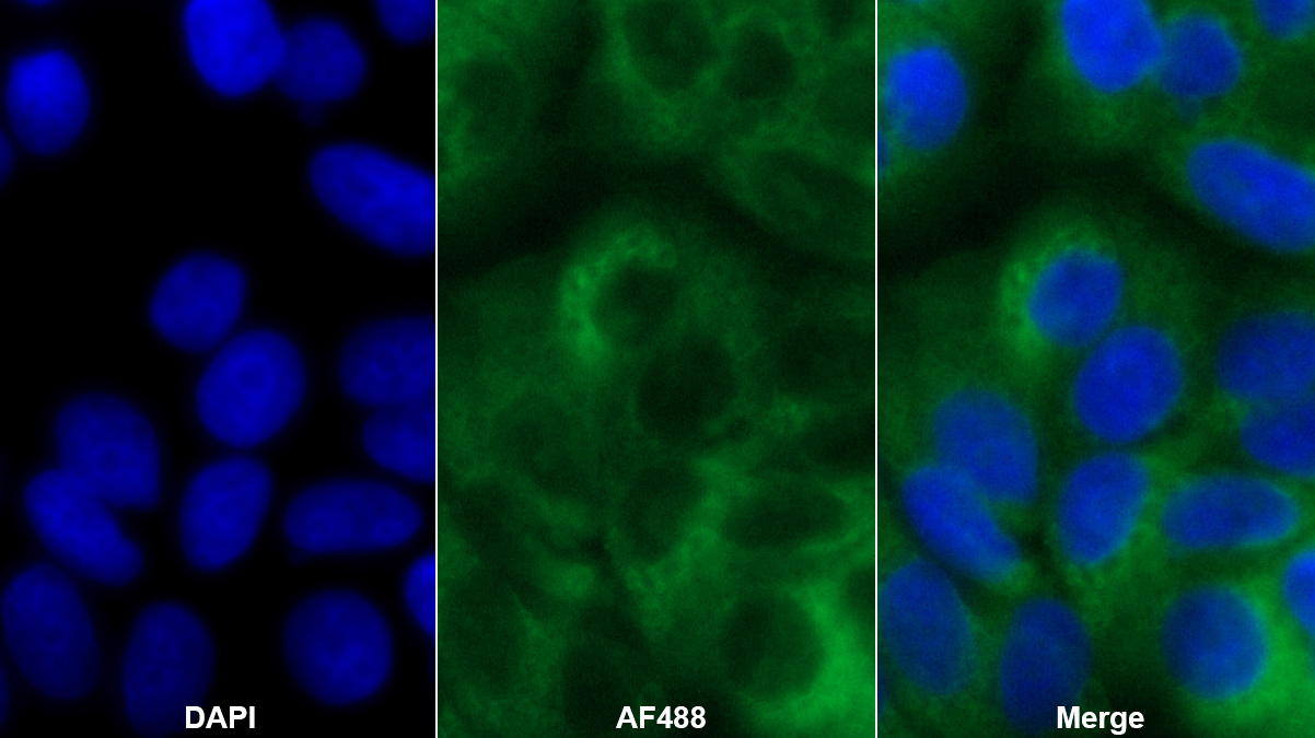 Polyclonal Antibody to Fission 1 (FIS1)