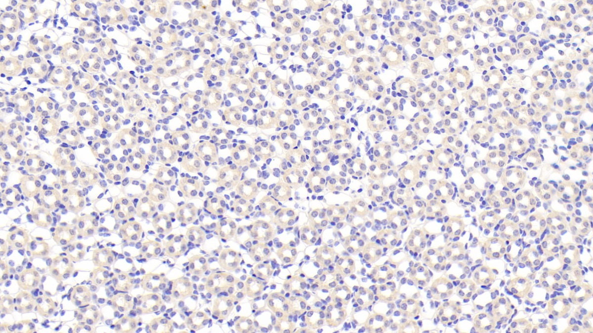 Polyclonal Antibody to Biglycan (BGN)