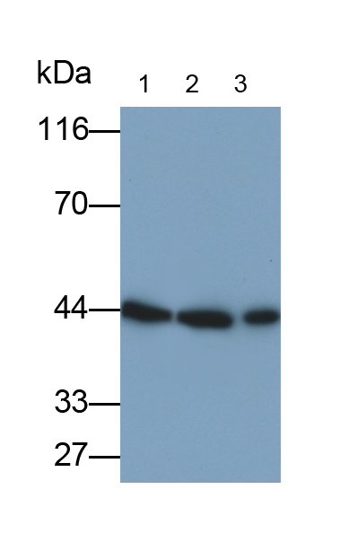 Polyclonal Antibody to Dolichyl Diphosphooligosaccharide Protein Glycosyltransferase (DDOST)