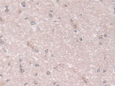 Polyclonal Antibody to Coxsackie Virus And Adenovirus Receptor (CXADR)