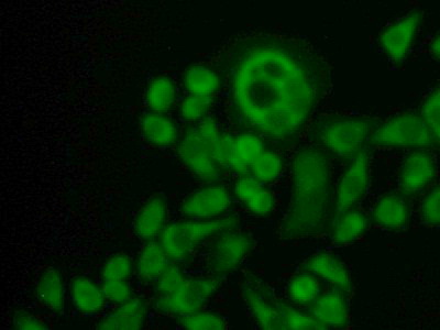 Polyclonal Antibody to Coxsackie Virus And Adenovirus Receptor (CXADR)