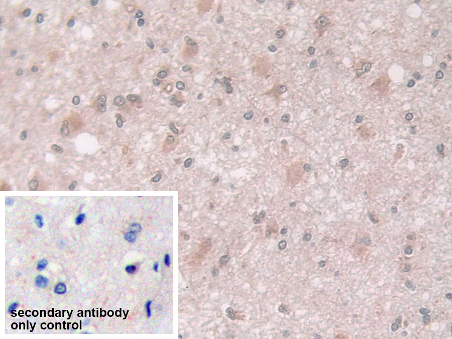 Polyclonal Antibody to Coxsackie Virus And Adenovirus Receptor (CXADR)