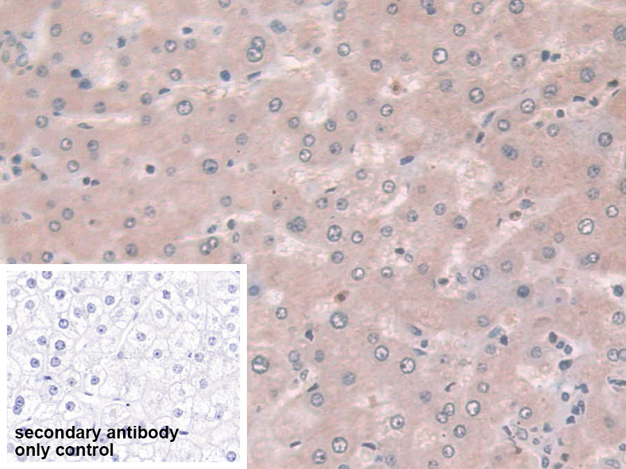 Polyclonal Antibody to Coxsackie Virus And Adenovirus Receptor (CXADR)