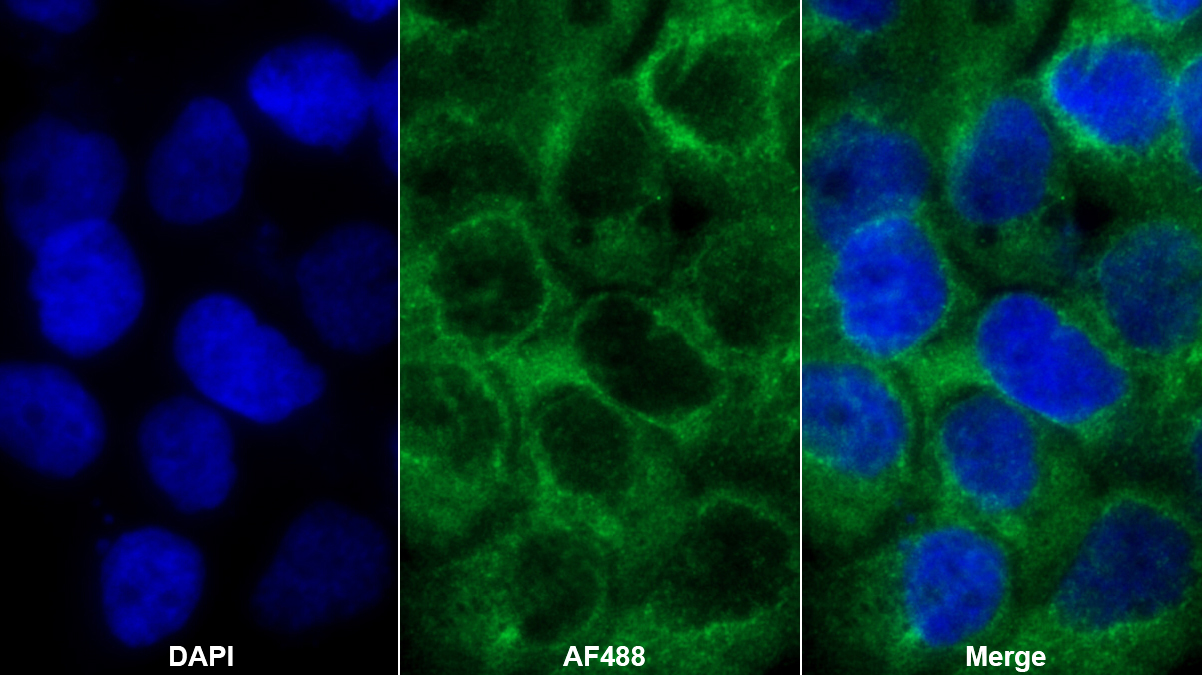 Polyclonal Antibody to Di-N-Acetyl Chitobiase (CTBS)