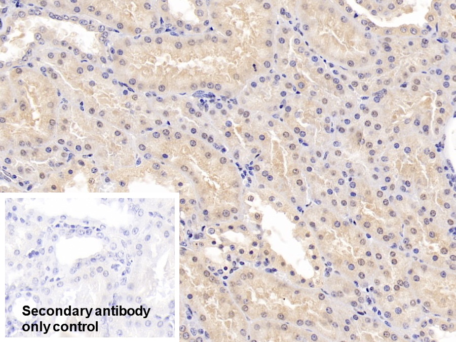 Polyclonal Antibody to Catechol-O-Methyltransferase (COMT)