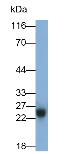 Polyclonal Antibody to Catechol-O-Methyltransferase (COMT)