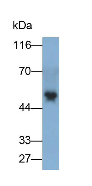 Polyclonal Antibody to Chitinase 1 (CHIT1)