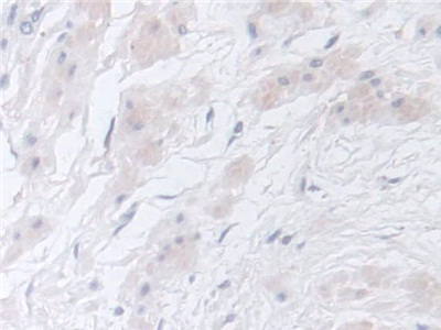 Polyclonal Antibody to Chitinase 3 Like Protein 2 (CHI3L2)