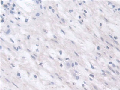 Polyclonal Antibody to Chitinase 3 Like Protein 2 (CHI3L2)