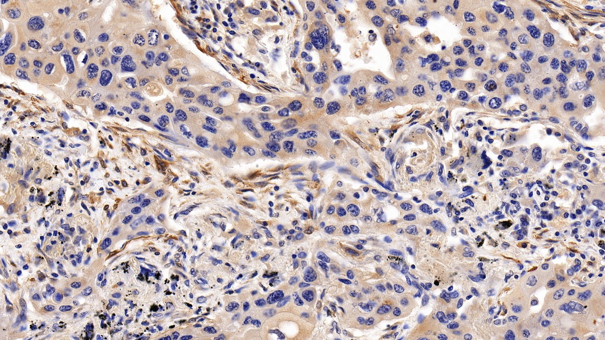 Polyclonal Antibody to Calponin 1, Basic (CNN1)