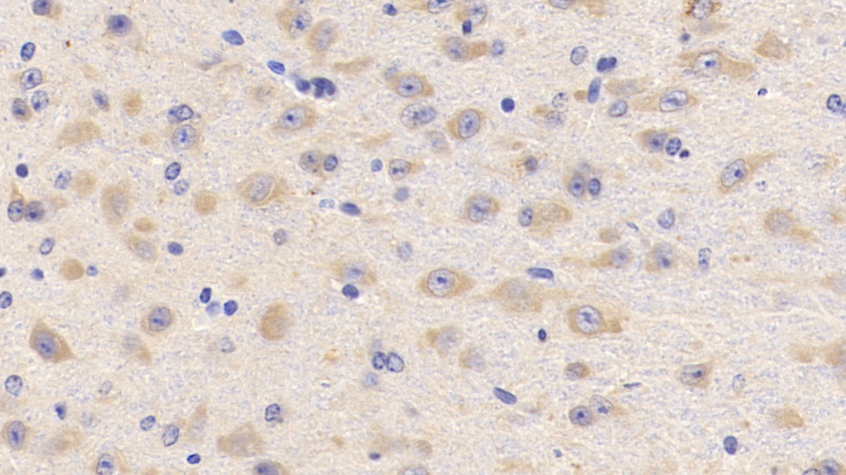 Polyclonal Antibody to Lecithin Cholesterol Acyltransferase (LCAT)