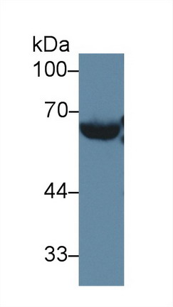 Polyclonal Antibody to Lecithin Cholesterol Acyltransferase (LCAT)