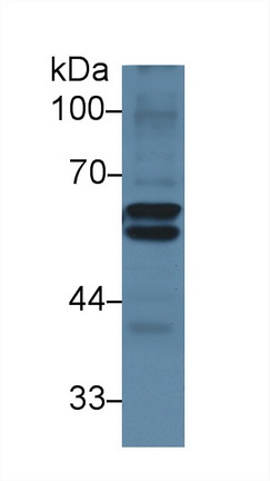 Polyclonal Antibody to Lecithin Cholesterol Acyltransferase (LCAT)