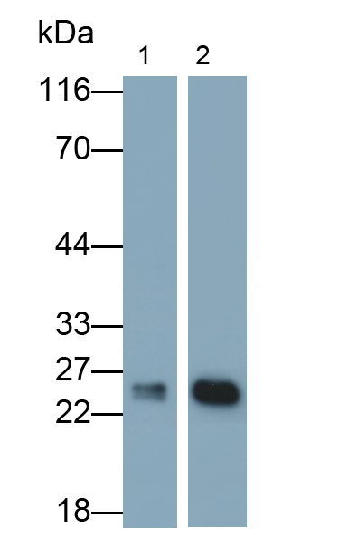 Polyclonal Antibody to Bcl2/Adenovirus E1B 19kDa Interacting Protein 3 (BNIP3)
