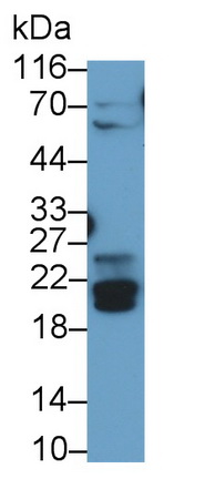 Polyclonal Antibody to Bcl2/Adenovirus E1B 19kDa Interacting Protein 3 (BNIP3)