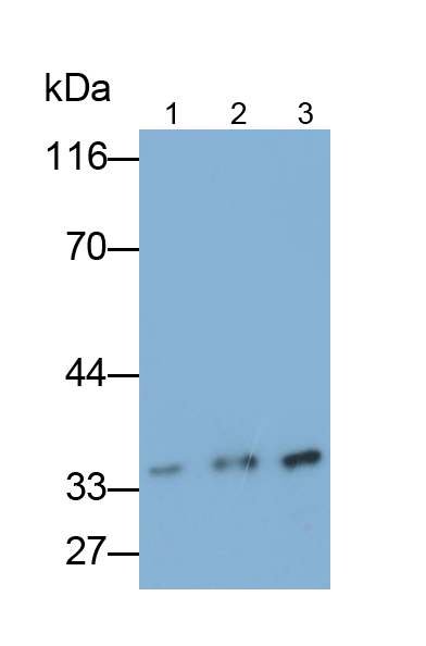 Polyclonal Antibody to Biliverdin Reductase A (BLVRA)