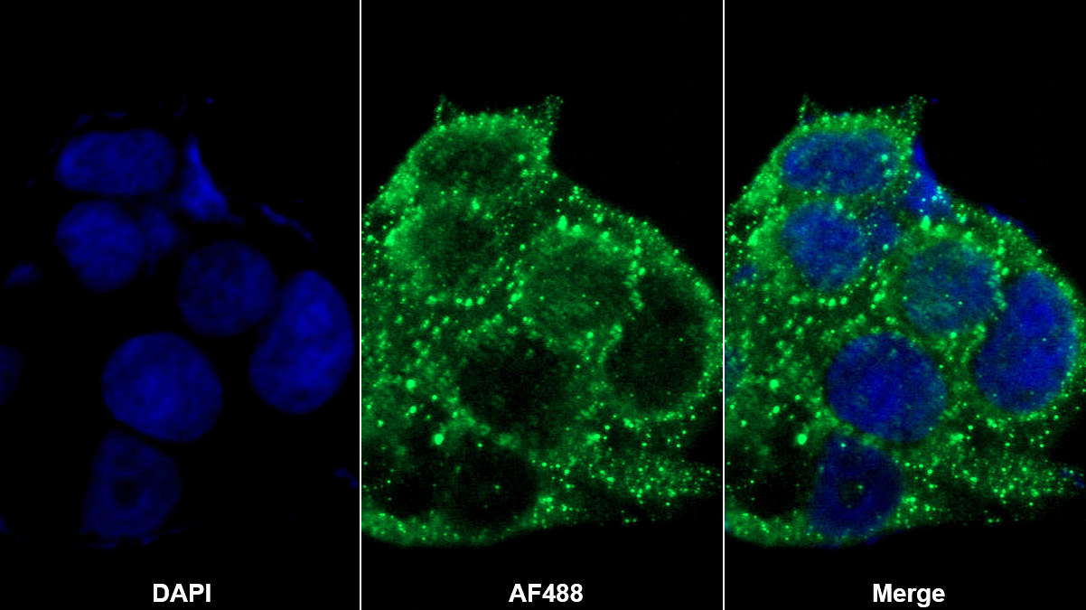 Polyclonal Antibody to Translocator Protein (TSPO)