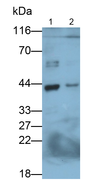 Polyclonal Antibody to Alpha-Methylacyl Coenzyme A Racemase (aMACR)