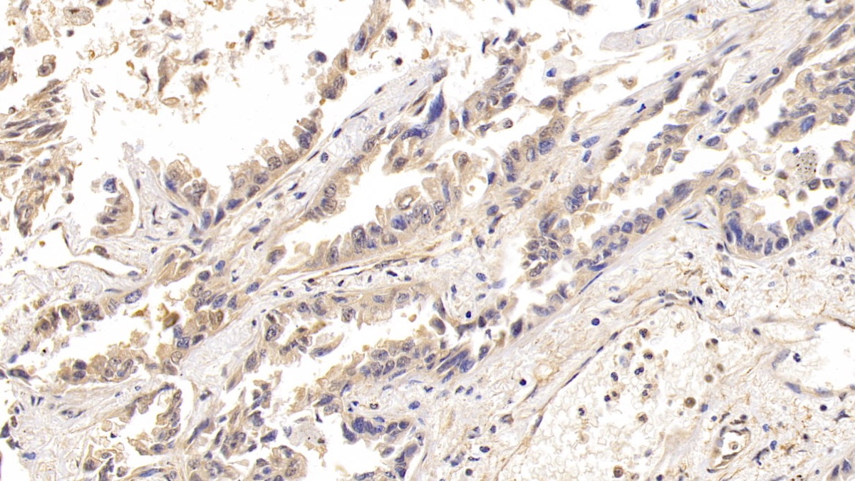 Polyclonal Antibody to Aconitase 1 (ACO1)