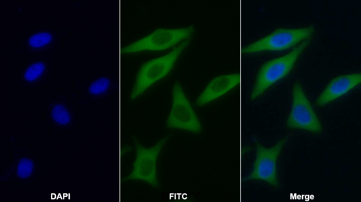 Polyclonal Antibody to Aconitase 1 (ACO1)