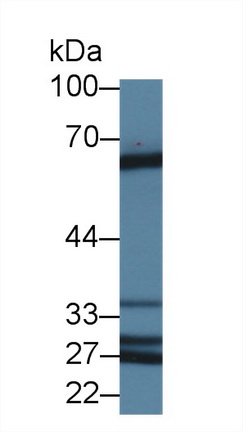 Polyclonal Antibody to Abl Interactor 1 (ABI1)