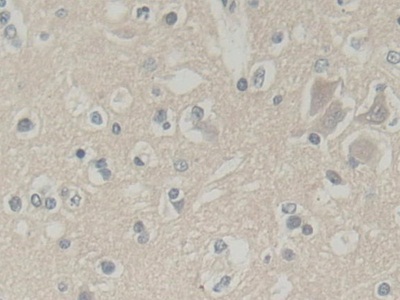 Polyclonal Antibody to Abl Interactor 1 (ABI1)