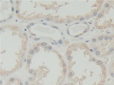 Polyclonal Antibody to Abl Interactor 1 (ABI1)