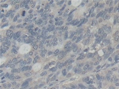 Polyclonal Antibody to Abl Interactor 1 (ABI1)