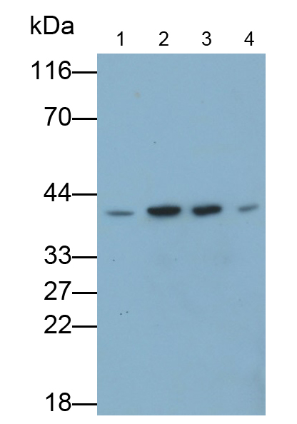 Polyclonal Antibody to H2A Histone Family, Member Y (H2AFY)