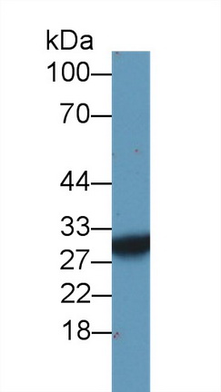 Polyclonal Antibody to Succinate Dehydrogenase Complex Subunit B (SDHB)