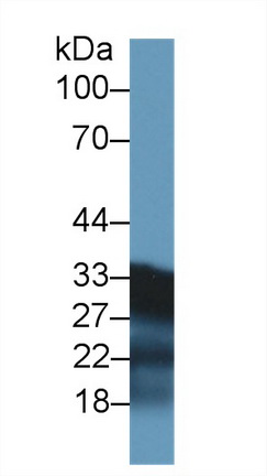 Polyclonal Antibody to Succinate Dehydrogenase Complex Subunit B (SDHB)