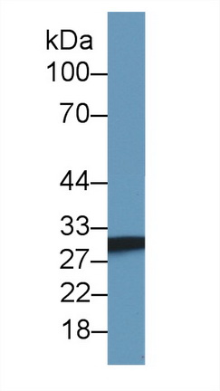 Polyclonal Antibody to Succinate Dehydrogenase Complex Subunit B (SDHB)