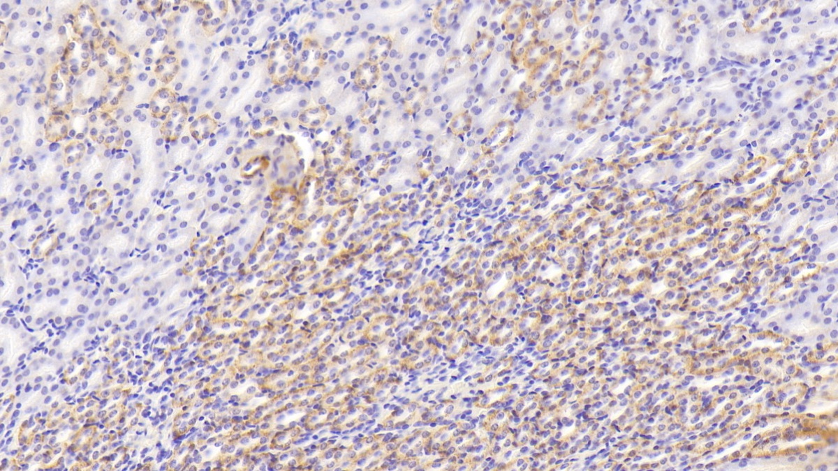 Polyclonal Antibody to Succinate Dehydrogenase Complex Subunit B (SDHB)