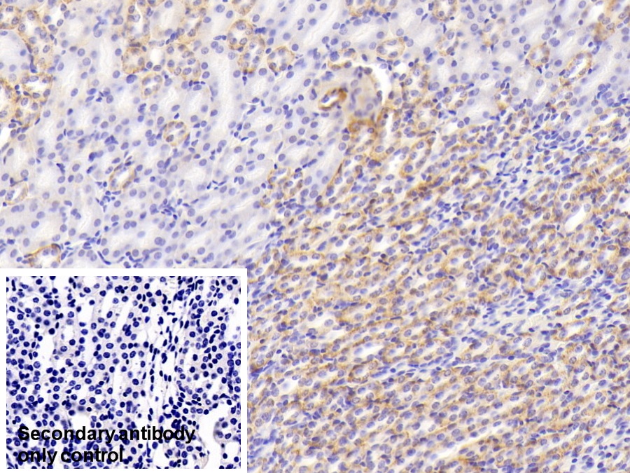 Polyclonal Antibody to Succinate Dehydrogenase Complex Subunit B (SDHB)