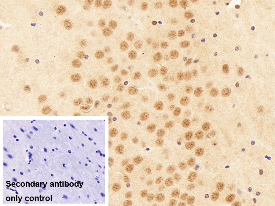 Polyclonal Antibody to HLA-B Associated Transcript 1 (BAT1)