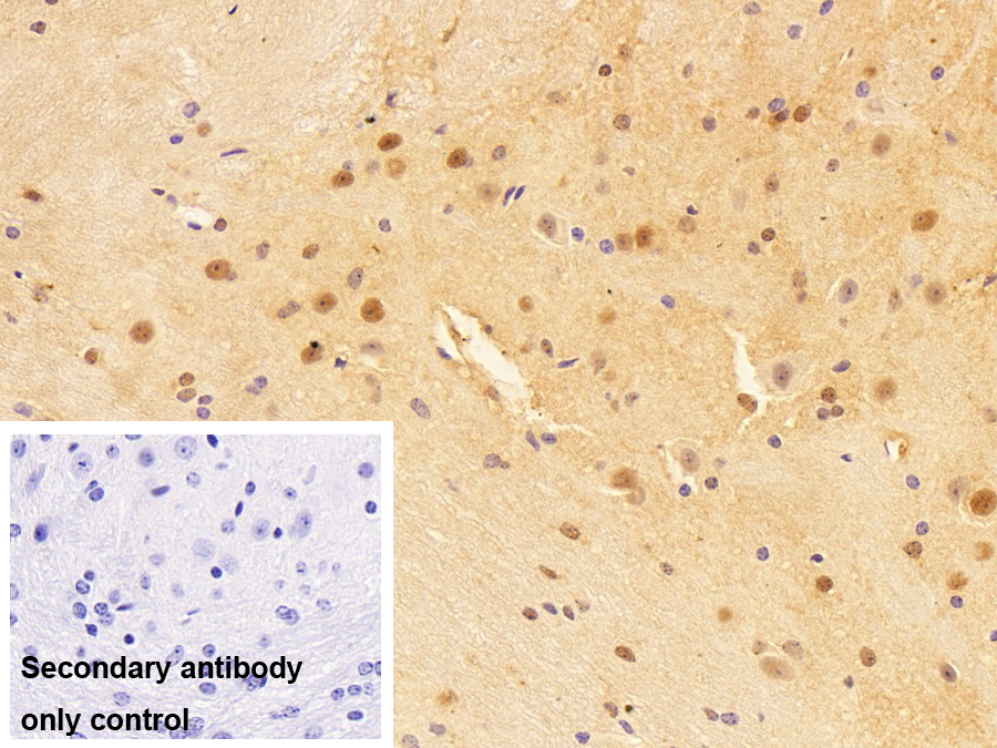 Polyclonal Antibody to HLA-B Associated Transcript 1 (BAT1)